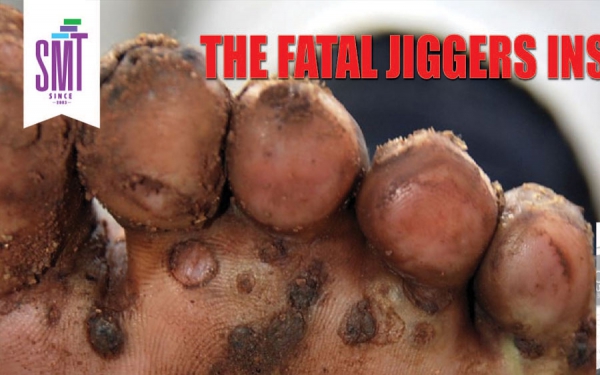 help eradicate the jiggers disease and restore dignity to the victims in africa 