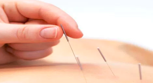 get the best horsham holistic therapy acupuncture tui na sports massage amp pers