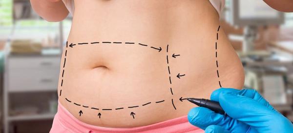 find the best price cape town plastic surgeons amp tummy tuck treatments here