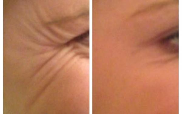 get the best anti aging bioenergy serum for rejuvenated amp youthful skin