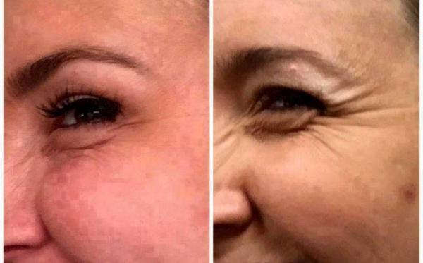 get the best anti aging bioenergy serum for rejuvenated amp youthful skin