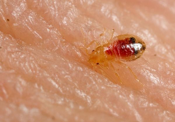 get fast professional bed bug extermination services from this specialist