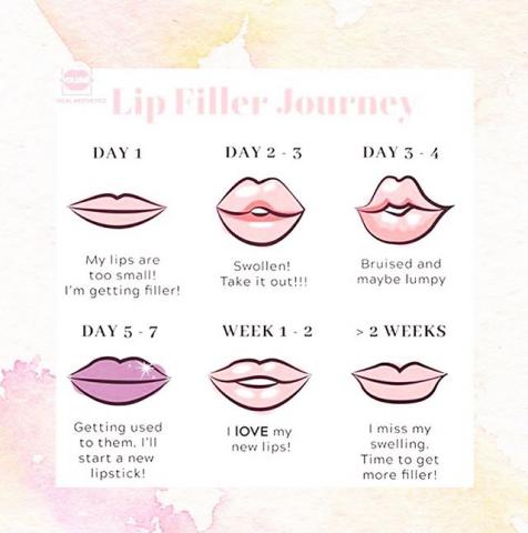 get the best sacramento anti wrinkle facials amp dermal fillers to look younger