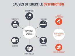 get the best scottsdale erectile dysfunction therapy without surgery