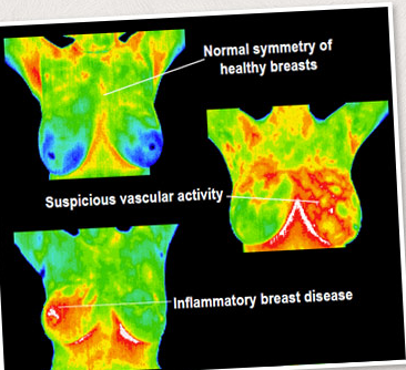 get expert breast amp full body thermography scans in albuquerque